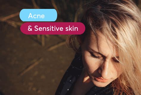 Tips for Treating Acne-Prone Sensitive Skin | MDacne