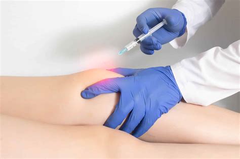 Euflexxa Injections: The Non-Surgical Solution to Relieving Knee Pain ...