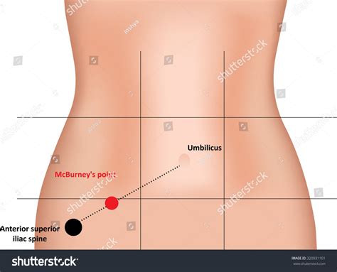 7 Mcburney's Point Images, Stock Photos, and Vectors | Shutterstock