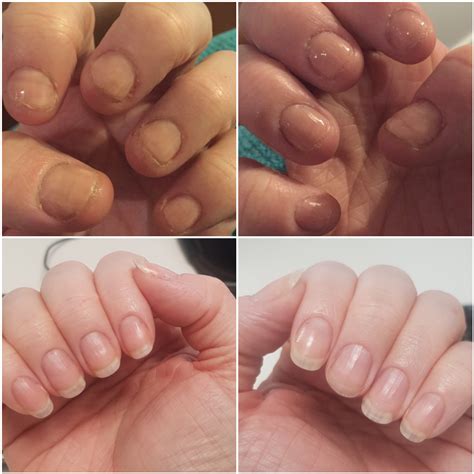 2 years worth of nail bed growth! My nails aren't the prettiest but they're better than they ...