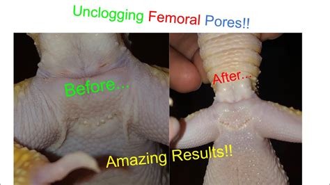 How To Unclog Femoral Pores!! - YouTube