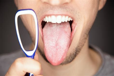 Why Is My Tongue White? - Here Is What You Want To Know - Healthwire