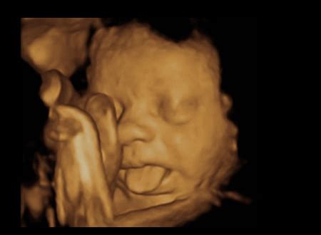 10 Amazing Ultrasound Photos - ultrasound pics, ultrasound photos - Oddee