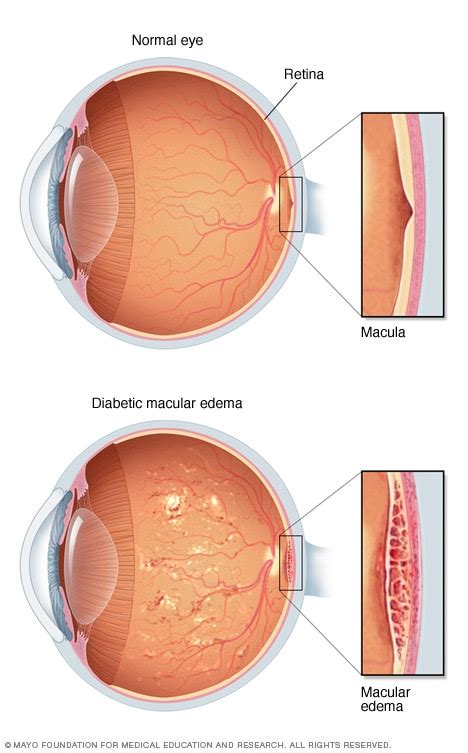 Rechazar tengo sueño tanto macula definicion ojo Él Asser Estructuralmente