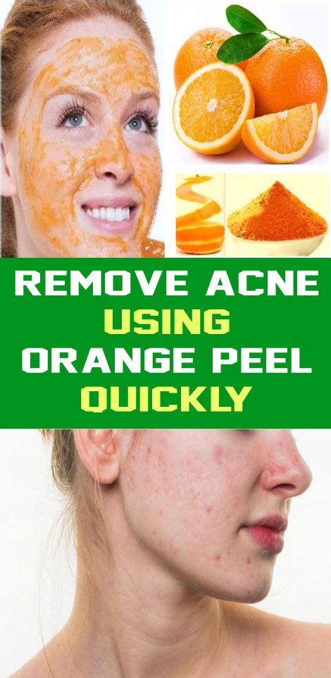 how to use orange peel for acne face - | Face acne, Orange peel, Orange peels uses