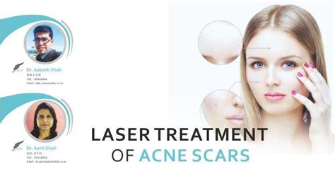 Laser Treatment of Acne Scars by Dr. Aakash Shah & Dr. Aarti Shah