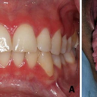 Extra-oral lesions/conditions. Patient #10 presenting cutaneous ...