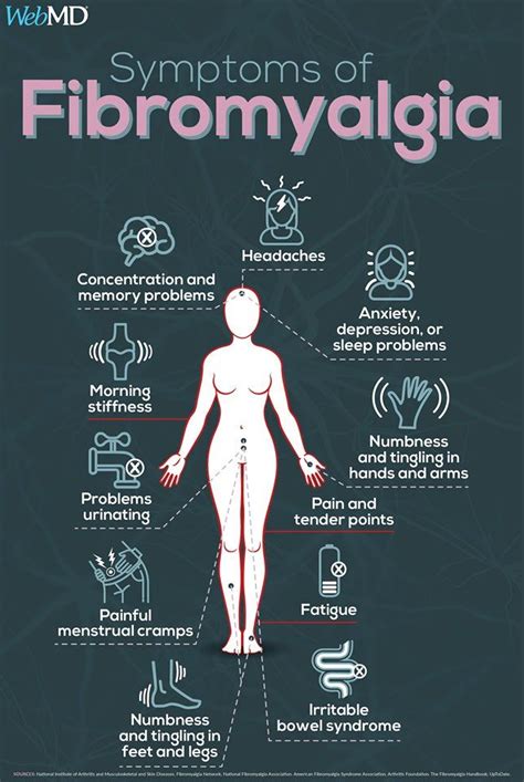 Signs Of Fibromyalgia, Fibromyalgia Pain Relief, Fibromyalgia Syndrome ...