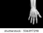 Anatomy High-tech Free Stock Photo - Public Domain Pictures