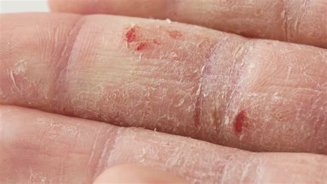 Fingers of a Man with Stock Footage Video (100% Royalty-free) 33784756 | Shutterstock