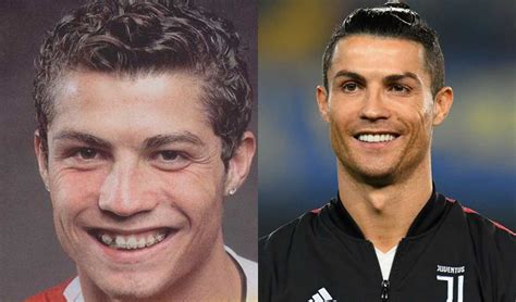 Cristiano Ronaldo Before After