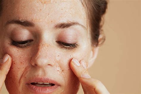 Top Signs of a Damaged Skin Barrier—and How to Fix It