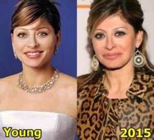 Maria Bartiromo Before and After - Plastic Surgery Diary