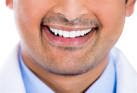 Cost Of Composite Veneers 2022: Best Dentists At Best Price