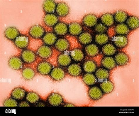 Transmission electron micrograph of rotavirus particles Stock Photo - Alamy