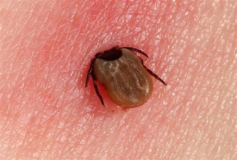 How Do Humans Get Ticks