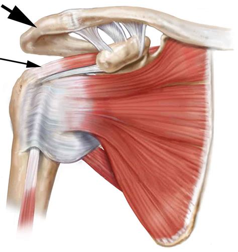 Chiarire freno inquinamento rotator cuff impingement syndrome Non approvato Alfabetizzazione mod