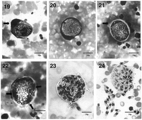 Life cycle of Hepatozoon canis (Apicomplexa : Adeleorina : Hepatozoidae ...