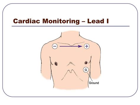 PPT - Cardiac Review PowerPoint Presentation, free download - ID:4452648