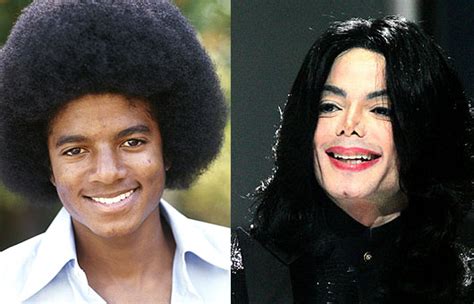 Michael Jackson Plastic Surgery Before and After Nose Jobs and Skin ...