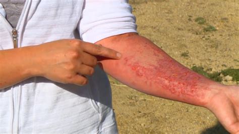 Wild parsnip, giant hogweed: Toxic plants to watch out for - CBS News