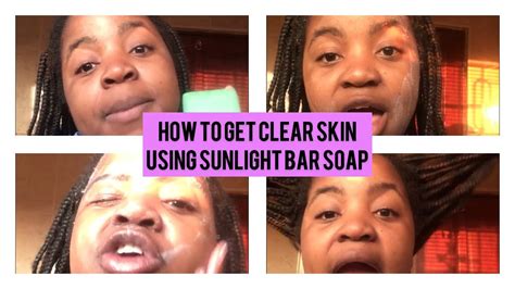 How to get clear skin using sunlight bar soap 🧼 || Skin care tips || - YouTube