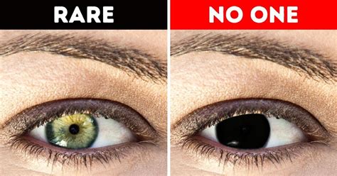 Why Humans Don’t Have Black Eyes - Filling