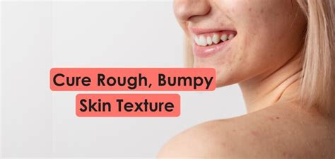 How to Improve Skin Texture: Grainy, Bumpy, Rough Skin