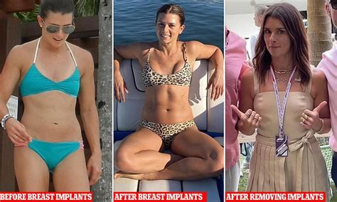 NASCAR racer Danica Patrick had breast implants removed after they ...