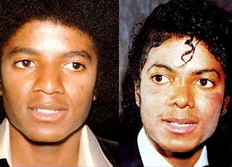 How did Michael Jackson change his skin color?