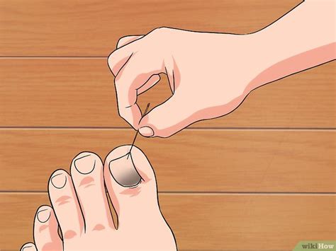 Safe Ways to Remove and Care for Dead Toenails