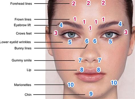 botox points for eyebrow lift - Google Search in 2020 | Botox injection sites, Eyebrow lift, Botox