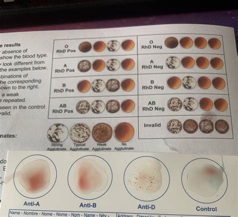 Help analyzing at-home blood type test? : DiagnoseMe