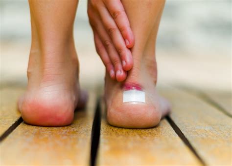 Have A Blister On My Foot Cheap Sale | emergencydentistry.com