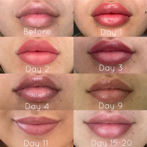 Lip Filler vs. Lip Flip vs. Lip Blushing: Which is right for me? - SAME ...