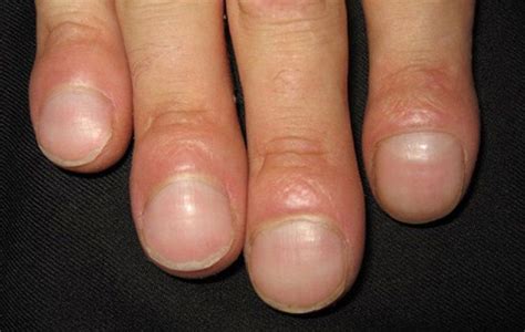 How Your Fingernails Are Trying To Warn You About Your Health