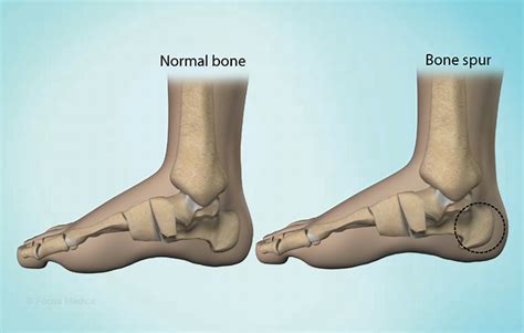 Health Condition : Symptoms, Causes, Treatment and More