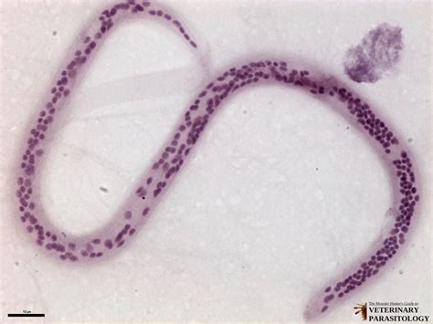 Wuchereria sp. Roundworms - MONSTER HUNTER'S GUIDE TO: VETERINARY PARASITOLOGY