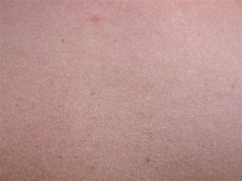 Текстура человеческой кожи (много фото) - deviceart.ru