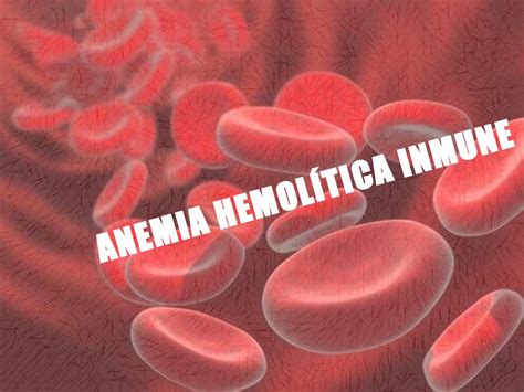 Anemia hemolítica inmune by APUNTES MEDICOS - Issuu