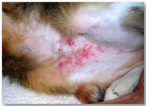 Flea Allergy Dermatitis On Humans