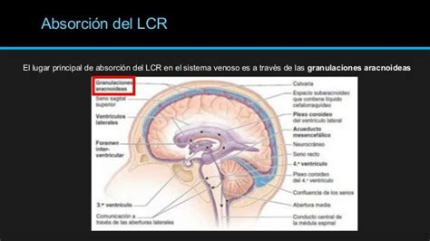 Plexos Coroideos