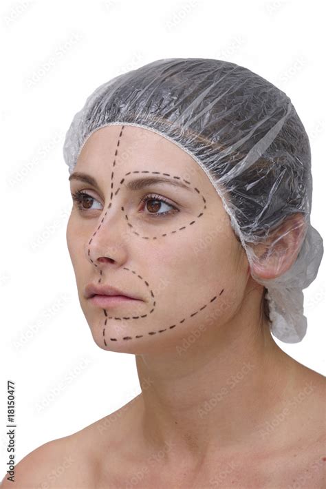 woman´s face before plastic surgery, face lift Stock Photo | Adobe Stock