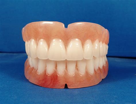 diy denture kit south africa - Like The Great Web Log Image Bank