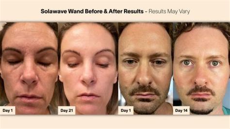 SolaWave is transforming skincare with light therapy | CNN Underscored