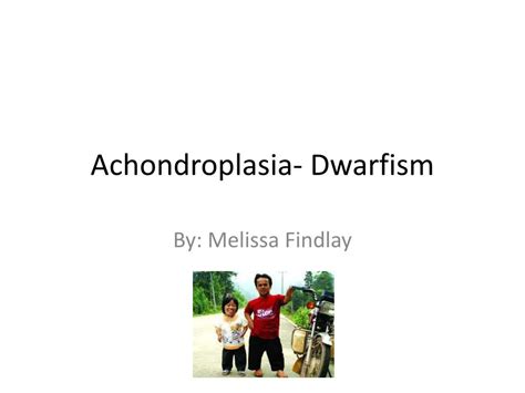 PPT - Achondroplasia- Dwarfism PowerPoint Presentation, free download - ID:2211298