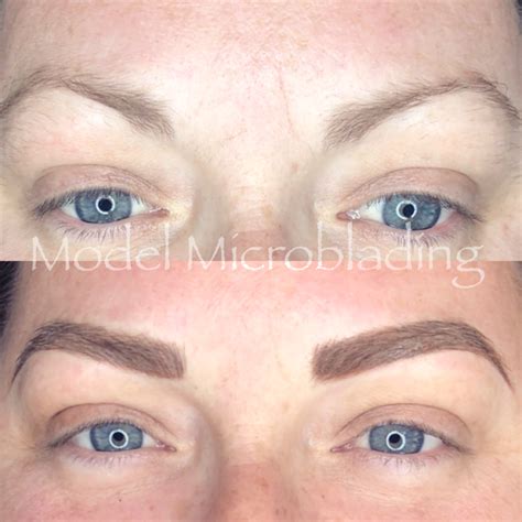 laser eyebrow tattoo removal melbourne - Jasmin Blalock