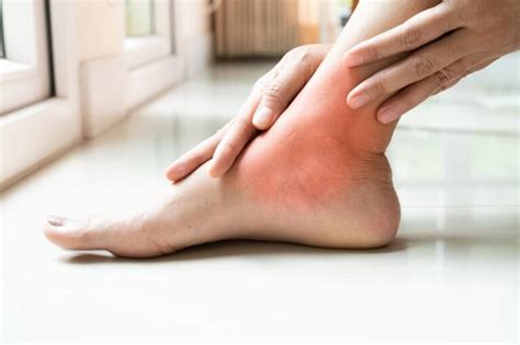 Foot Eczema vs. Athlete's Foot: What's the Difference? - Healing X Change