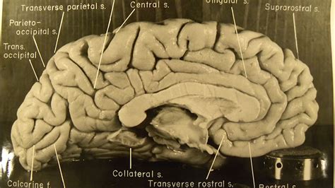 Studying the unique features of Albert Einstein's brain | Britannica