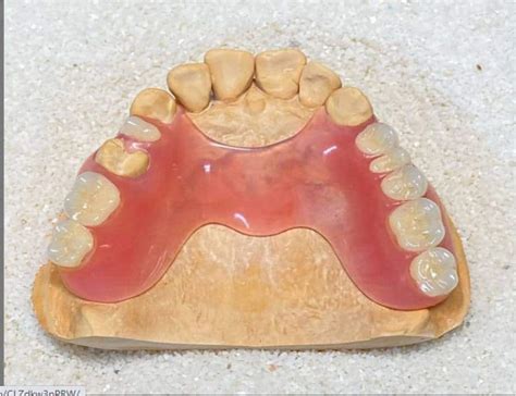 Flexi Valplast Dentures NYC